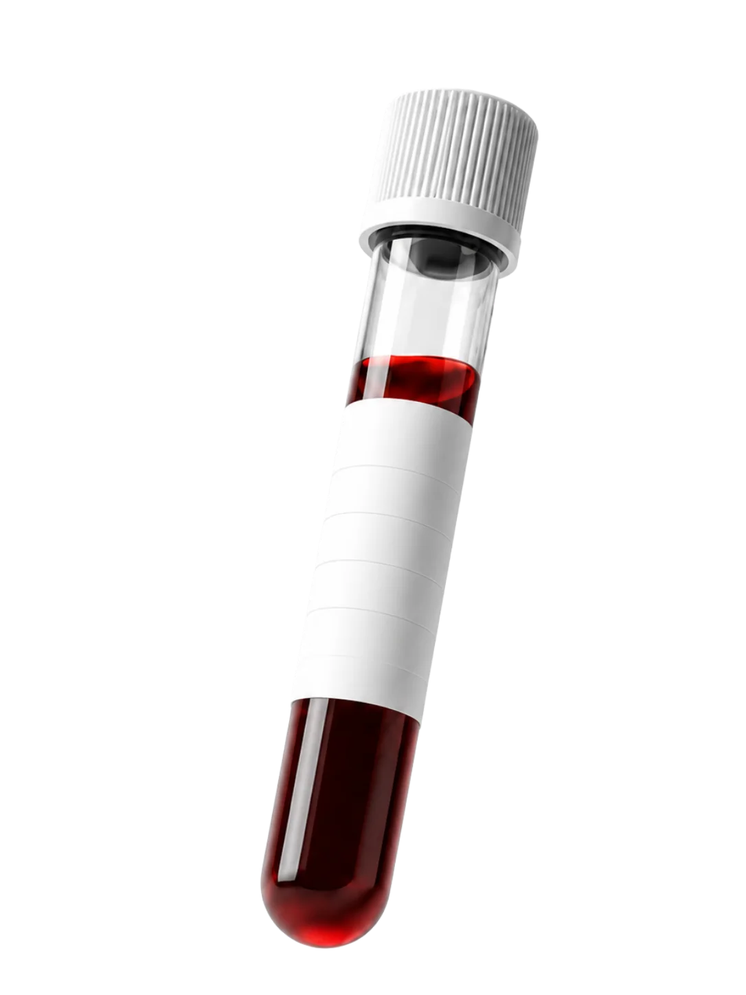 Blutprobenröhrchen mit roter Blutprobe und weißem Etikett